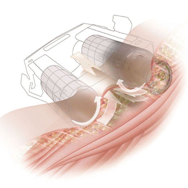 エンダモロジー(Endermologie) KM-2s 標準ヘッド