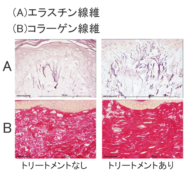 ・血流増加・コラーゲン画像