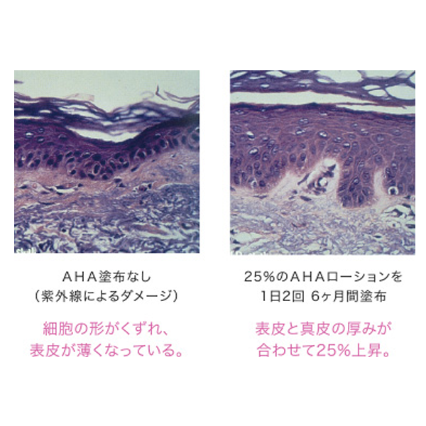 紫色皮膚断面図　画像